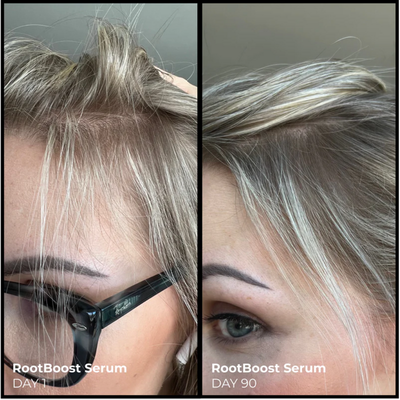 Better Roots RootBoost Serum Value Pack