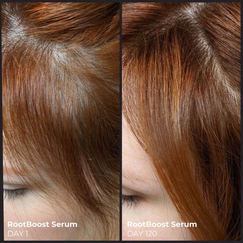 Better Roots RootBoost Serum Value Pack